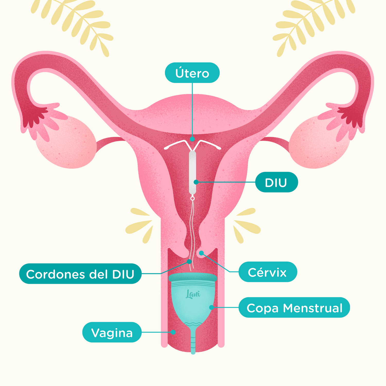 ¿Se puede usar copa o disco menstrual con DIU?